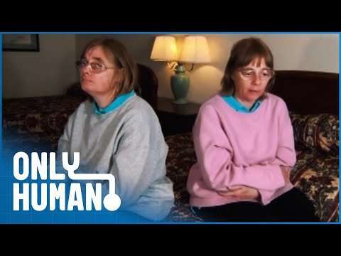 We're The World's Only Female Autistic Savant Twins