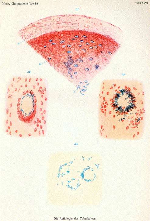 Koch's drawing of tuberculosis bacilli in 1882 (from Die Ätiologie der Tuberkulose)