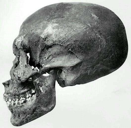 Profile view of the skull (thought to be Akhenaten) recovered from KV55.
