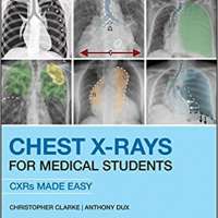 Chest X-Rays for Medical Students: CXRs Made Easy