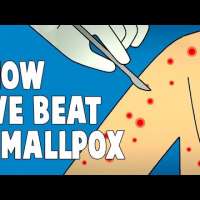 How we conquered the deadly smallpox virus - Simona Zompi
