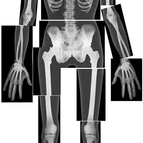 Roylco True to Life Human X-Rays