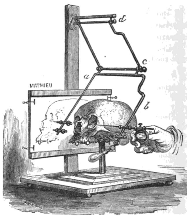 Stereograph designed by Paul Broca and manufactured by Mathieu