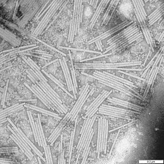 An electron micrograph of tobacco mosaic virus