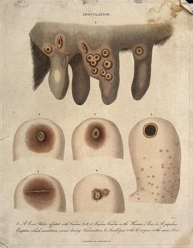 Jenner's discovery of the link between cowpox pus and smallpox in humans helped him to create the smallpox vaccine.